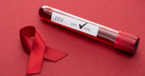 Ove godine 12 novozaraženih lica HIV-om, zabilježen smrtni slučaj