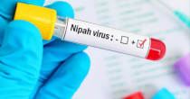 Virus Nipah: Koliki je rizik za Srpsku i na šta putnici moraju paziti