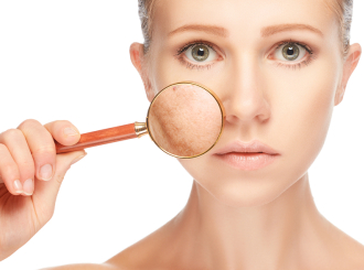 Greške zbog kojih fleke na licu postaju još vidljivije