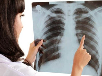 Nedjelja borbe protiv tuberkuloze