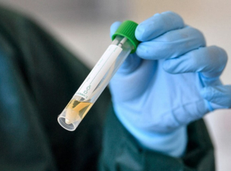 Još 16 osoba u Srpskoj pozitivno na virus korona