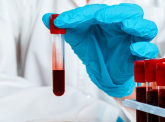 Masovno serološko testiranje u septembru