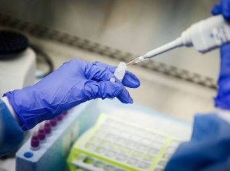 Još 30 oboljelih od virusa korona u RS, najviše iz Banjaluke