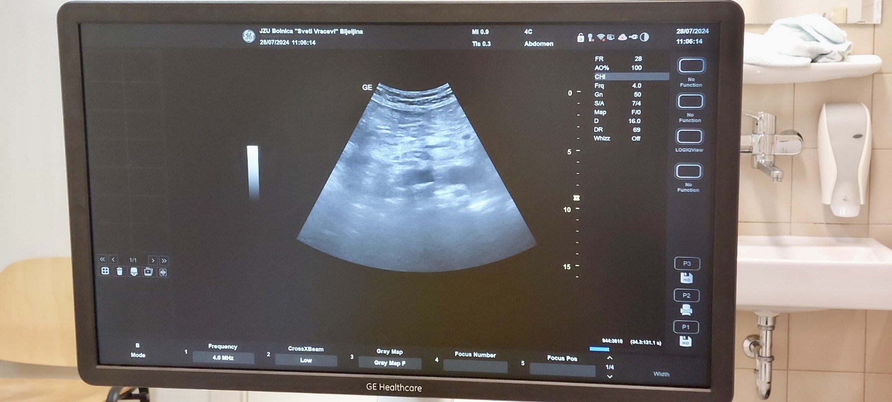 Nedjelja u bijeljinskoj bolnici u znaku besplatnih preventivnih pregleda trbušne aorte