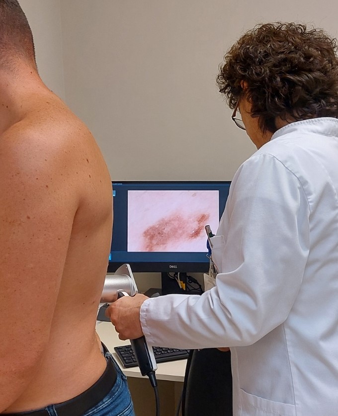 Bijeljina: Preventivna akcija skrininga mladeža dermoskopom u Bolnici "Sveti Vračevi"