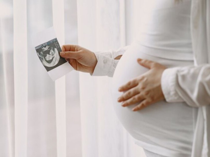 Koji su uslovi za refundaciju troškova za NIPT test?