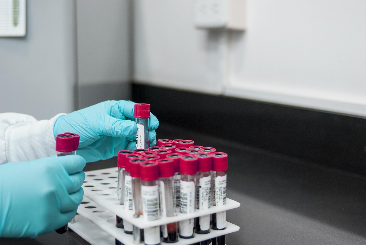 Fond zdravstvenog osiguranja: Pojednostavljena procedura za NIPT test
