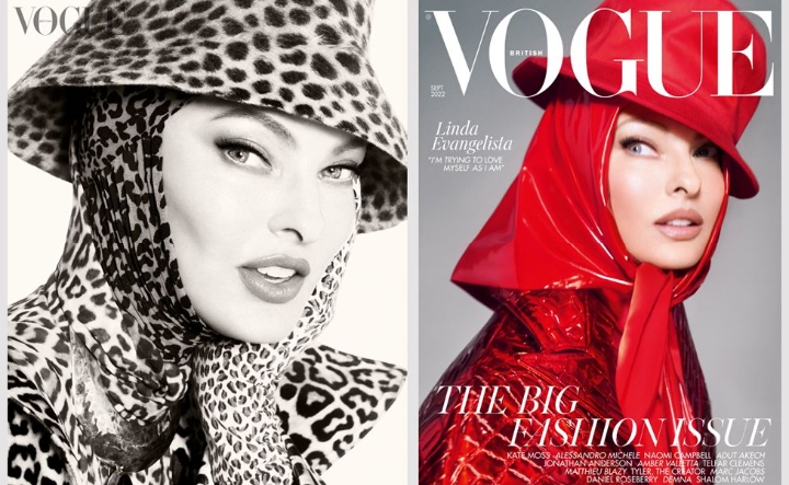 Supermodel na naslovnoj strani magazina Vog posle zahvata koji joj je deformisao telo
