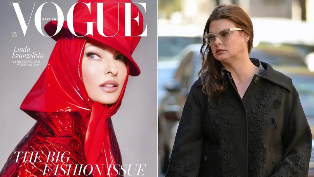 Supermodel na naslovnoj strani magazina Vog posle zahvata koji joj je deformisao telo