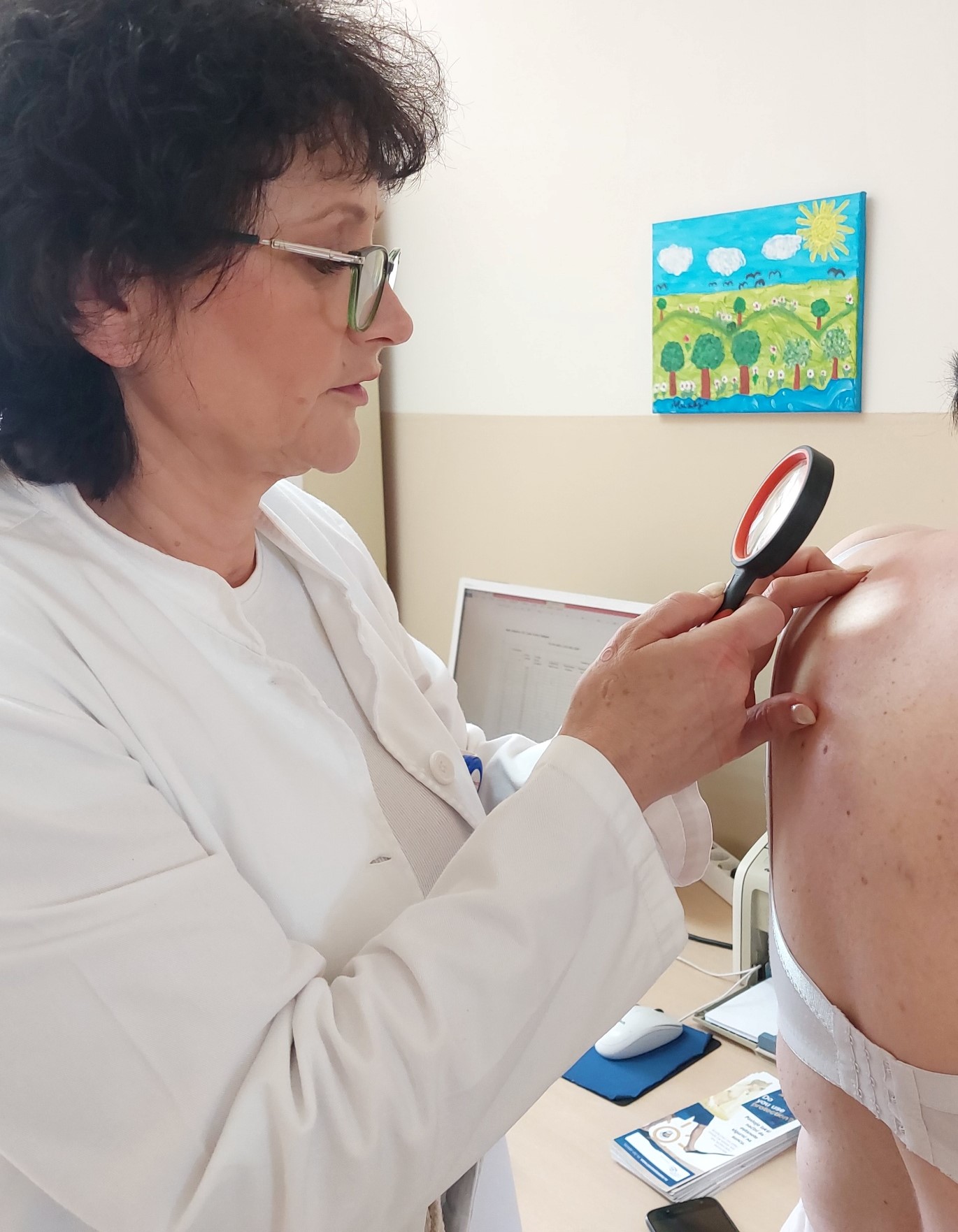 Bijeljinska bolnica: Rano otkrivanje melanoma spašava život