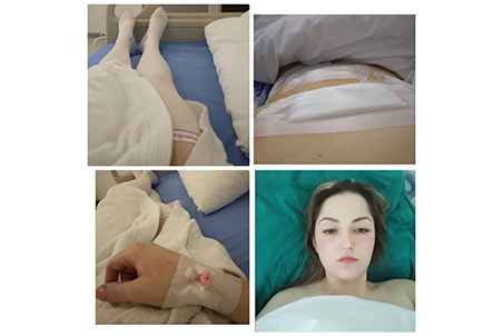 Nataša (27) treba pomoć u velikoj borbi za zdravlje