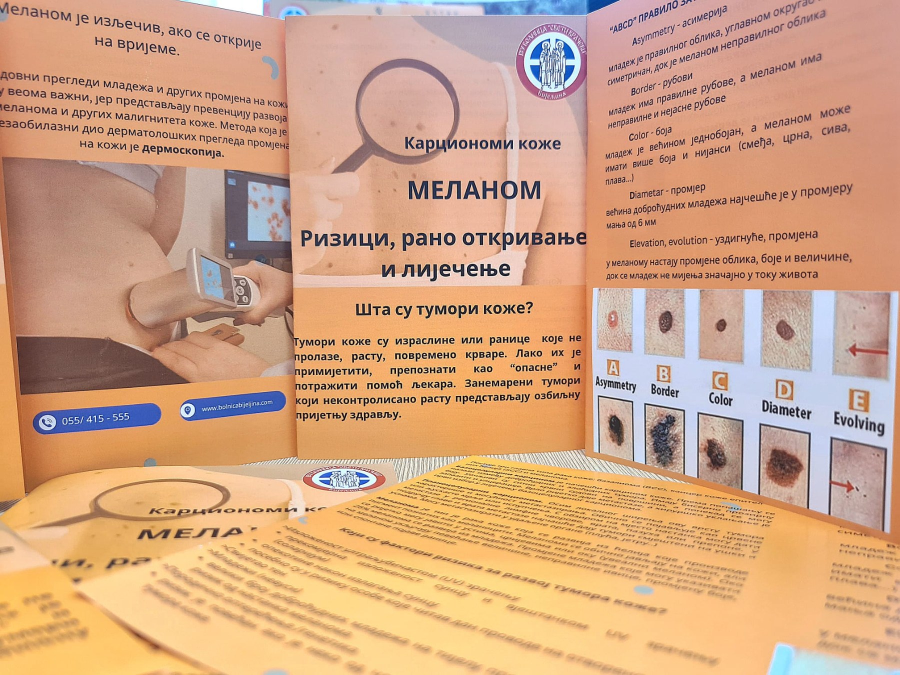 Bolnica Bijeljina: Besplatni pregledi kože na melanom